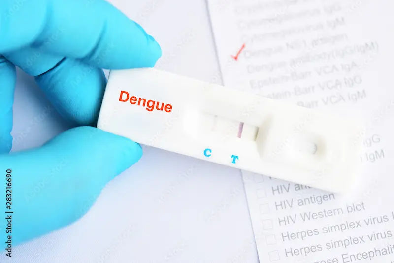 Dengue Diagnosis Test Overview